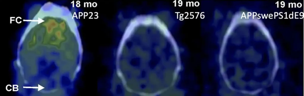 Avances en la Investigación del Alzheimer: Reversión de la Enfermedad en Modelos Animales