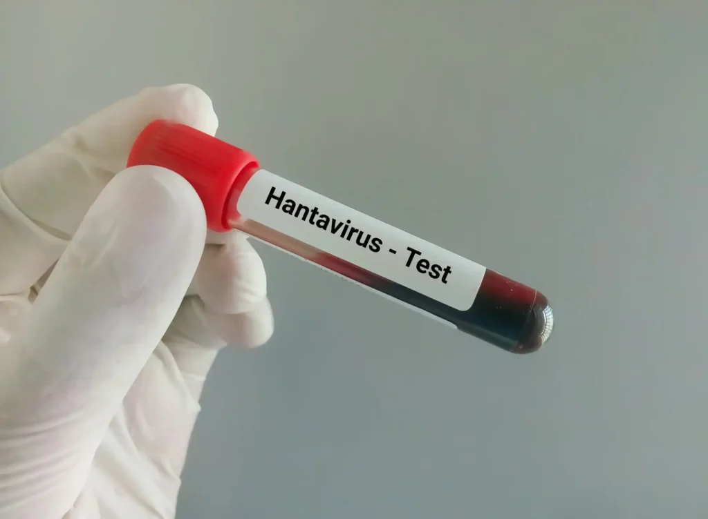 Hantavirus Canarias: brote, crucero y riesgo real en 2026